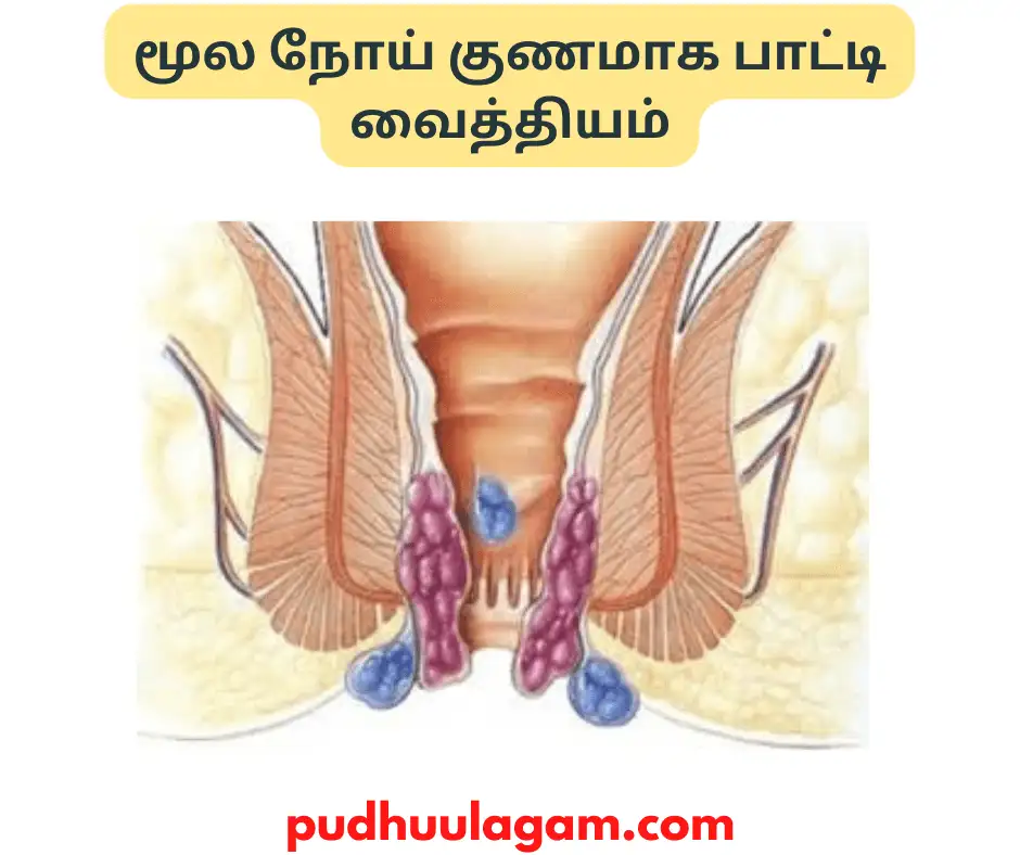 மூல நோய் குணமாக பாட்டி வைத்தியம்